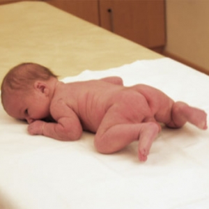 Фото к статье Гормональный криз у новорожденных 4.jpg