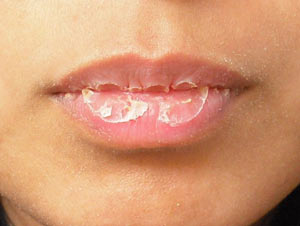 Фото к статье Как защитить губы от обветривания 3.jpg