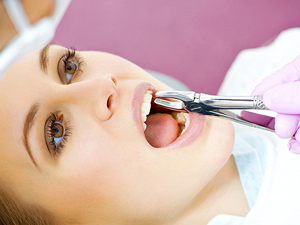 Фото к статье Уход за полостью рта после удаления зубов 1.jpg