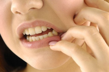 Фото к статье Как избавиться от зубного камня в домашних условиях 3.jpg