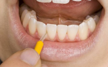 Фото к статье Как ухаживать за зубными протезами 5.jpg