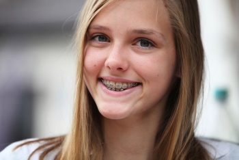 Фото к статье Уход за зубами у подростков 4.jpg